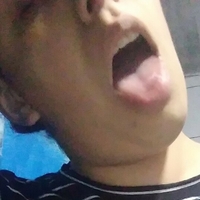 Абайродр Оголені