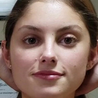 Др. Густаво Кірос Лікона Оголені