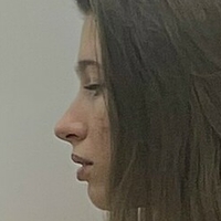 кеттіестетик Оголені